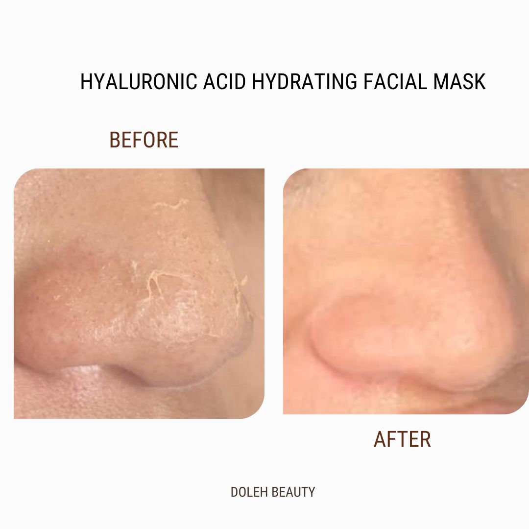 Hyaluronic Acid Hydrating Facial Mask - before and after